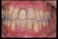 NKN-000043-D.jpg NKN-000043-D.jpg