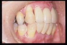 NKN-000046-B.jpg