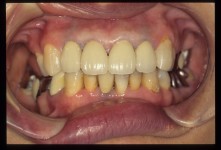 NKN-000222-B.jpg