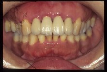 NKN-000226-B.jpg