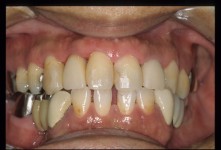 NKN-000240.jpg